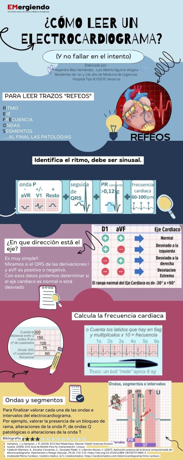 ¿Cómo Leer Un Electrocardiograma? - EMergiendo